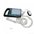 Digital PalmSmart Ultrasound Scanner