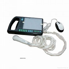 Digital PalmSmart Ultrasound Scanner  MK-3000