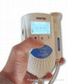 CE FDA Fetal doppler LCD Screen (Sonoline B)