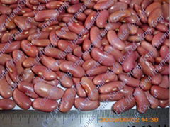 red kidney beans