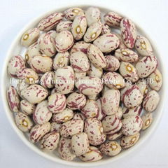 Light Speckled Kidney Beans