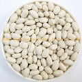 Japanese White Kidney Beans 1