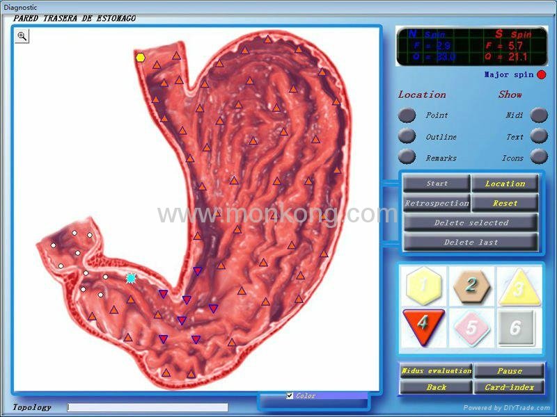 3D NLS Sub Health Analyzer 4