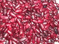 dark red kidney beans 1