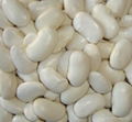 large white kidney bean