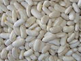 meduim white kidney bean 1