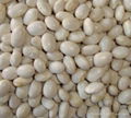 small white kidney bean 1