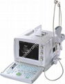 S880 portable Ultrasound Scanner digital