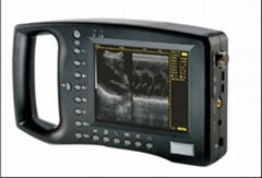 palm held ultrasound scanner S550 