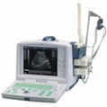 Ultrasound Scanner