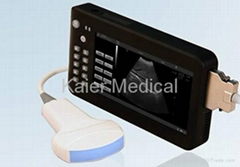 palm size Ultrasound Scanner