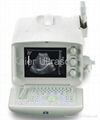Portable Ultrasound Scanner 1