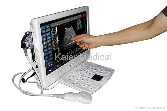  Touch Screen LCD Ultrasound Scanner