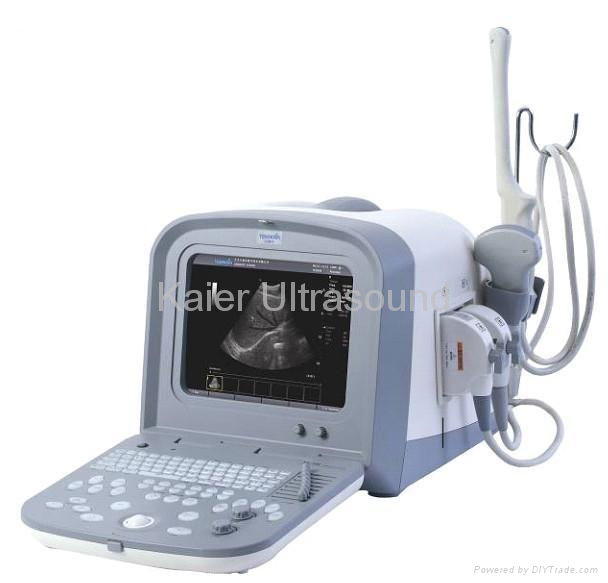 Full Digital Ultrasound Diagnostic System 