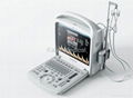 Portable Color Doppler Ultrasound System