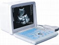Portable Ultrasound Scanner 1