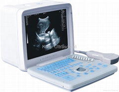 Portable Ultrasound Scanner