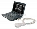 laptop type ultrasound scanner