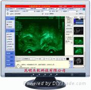 杰软超声影像系统工作站