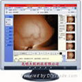杰軟紅外乳腺影像系統工作站 1