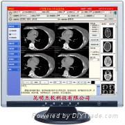 杰软CT影像系统工作站