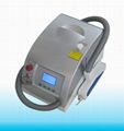 RY280 laser tattoo removal 1