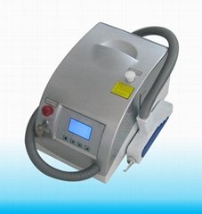 RY280 laser tattoo removal