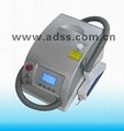 RY280 laser tattoo removal 3