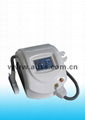 RY580 laser tattoo removal 1