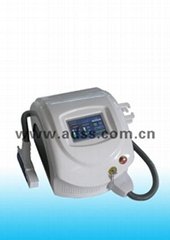 RY580 laser tattoo removal