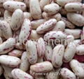 Light speckled kidney bean 1