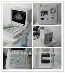 DW360 portable convex ultrasound scanner