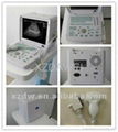 DW360 portable convex ultrasound scanner 2