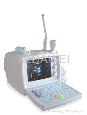 DW360 portable convex ultrasound scanner 3