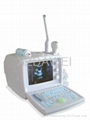 DW360 portable convex ultrasound scanner 3