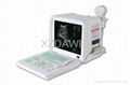 DW360 portable convex ultrasound scanner 4
