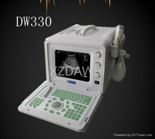 DW330 portable ultrasound scanner 2