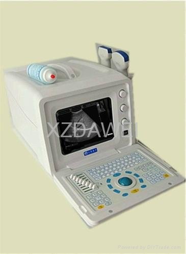 DW3101A ultrasound scanner 2