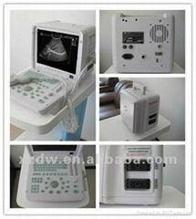 full-digital ultrasonic diagnostic apparatus DW360