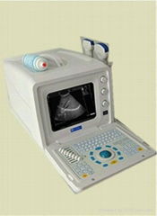 DW3101A Portable B-type ultrasonic diagnostic apparatus