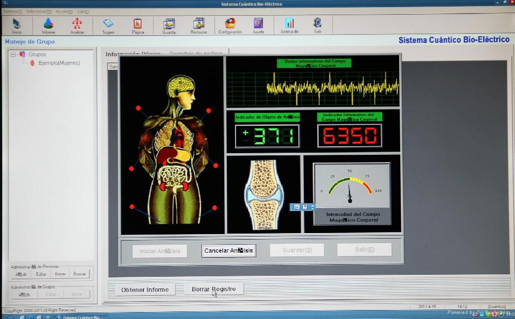 Quantum body health analyzer  3