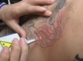 ND YAG Mini Laser Tattoo Removal Machine ND-506 3