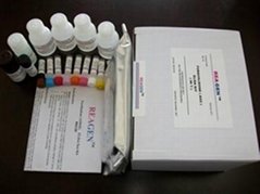 麻痹性贝类毒素PSP快速定量检测试剂盒Elisa
