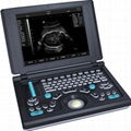 Digital Laptop Ultrasound Scanner(BW590)