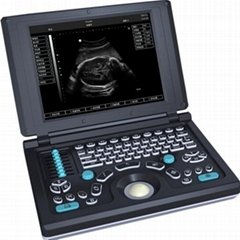Digital Laptop Ultrasound Scanner(BW590)