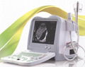 Digital Ultrasound Scanner (BW530)