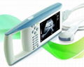 Digital Palmtop Ultrasound Scanner(BW520)  1