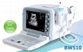 Digital Ultrasound System (BW510) 