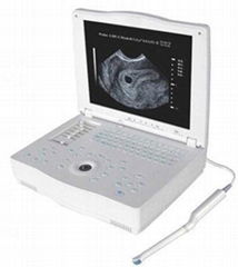 Laptop Ultrasound Scanner (BW8H)