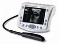 Esaote Tringa Linear Ultrasound System